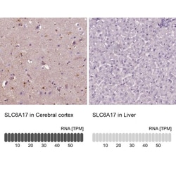 SLC6A17 Antibody, Novus Biologicals 0.1mL; Unlabeled:Antibodies, Polyclonal